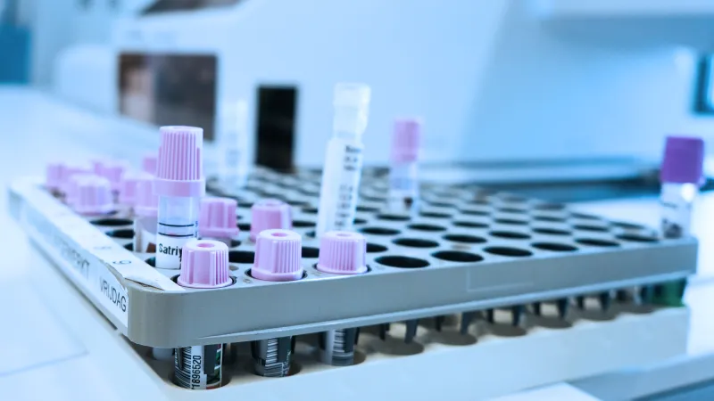 Onderzoeksassistent / oproepkracht Werken bij Erasmus MC